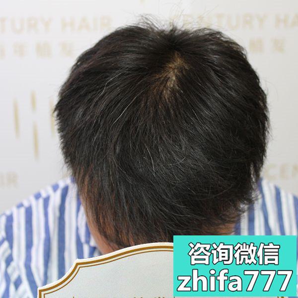 常州百年稀少加密种植，找回自信了