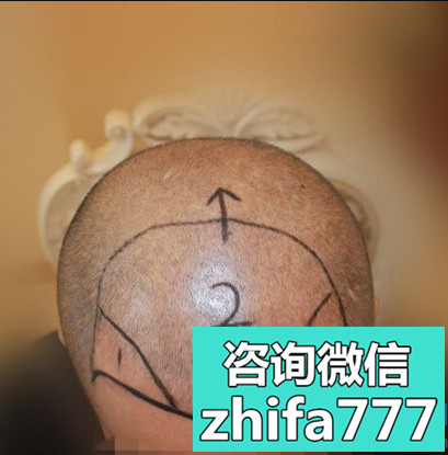 海南韩美稀少加密种植自然哦
