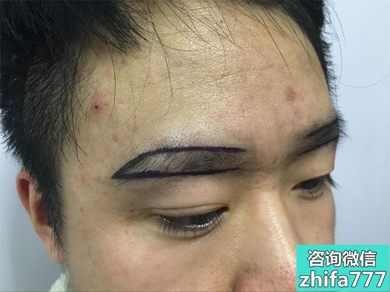 广州碧莲盛眉毛种植效果怎么样
