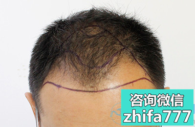 上海新生稀少加密种植，让我变得特别自信