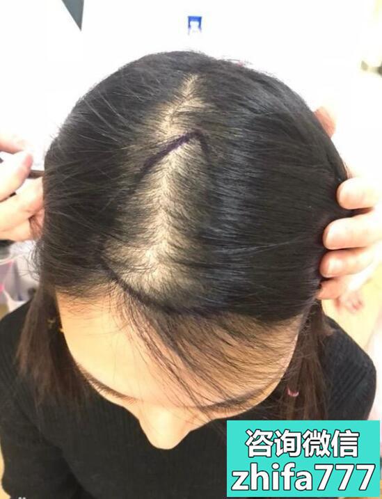 大连瑞丽稀少加密种植怎么样