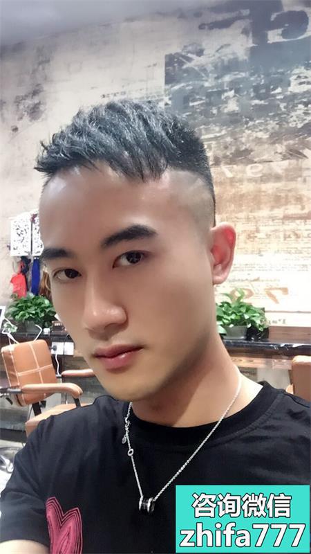 重庆新生发际线种植，效果非常满意