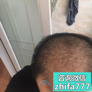 昆明丽都稀少加密种植案例分享