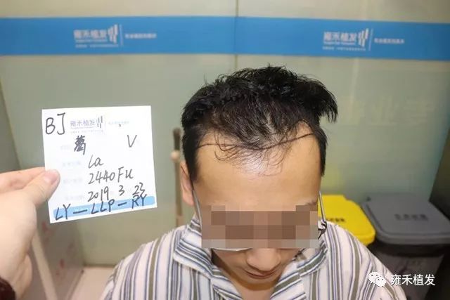 他要进植发手术室母亲和大姨来电话不要植发不要被骗