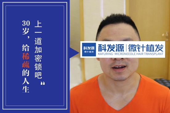 我在科发源植发两年没有失败才知道植发的水有多混