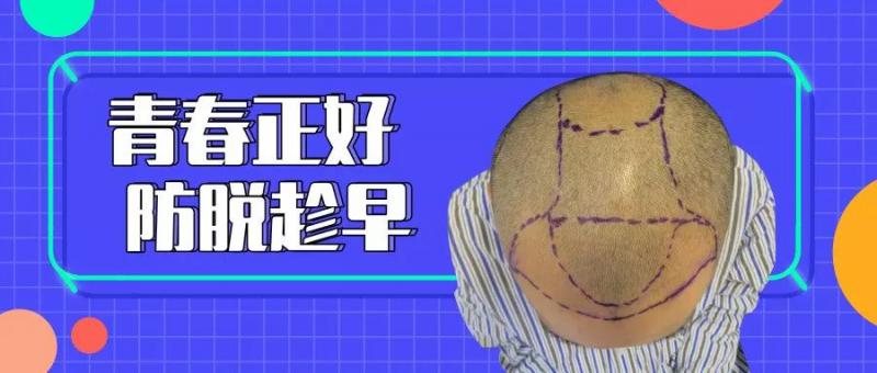 西安发友植发头发种植4080毛囊单位直接逆袭青春