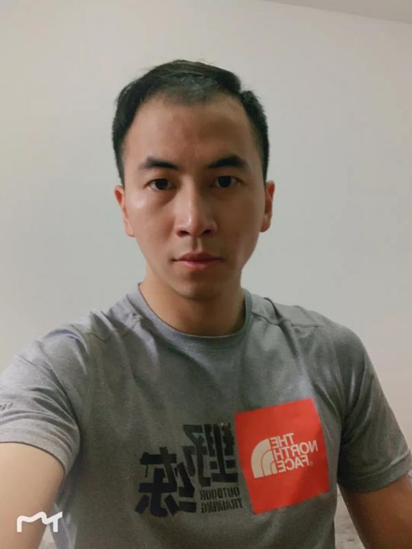 撸铁小哥大麦微针植发「科发源微针植发」后太帅了一身腱子肉