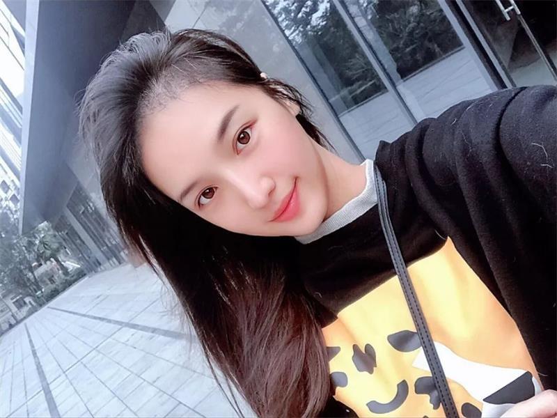 萌妹子微针植发3000单位调整发际线变成女神脸！