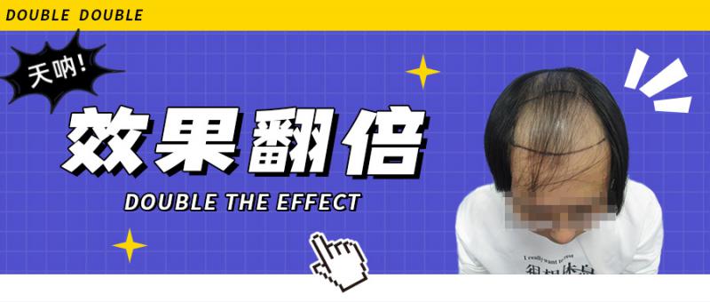 植发效果翻倍，原来是术后做了这件事！