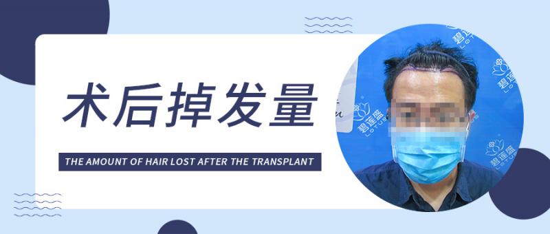 植发半年了，每天还掉五六十根头发，正常吗？