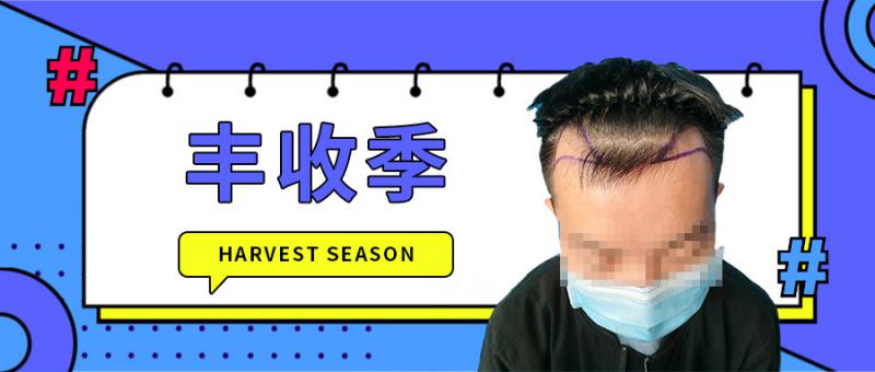 植发后多久可以下地干活？影响正常上班吗？