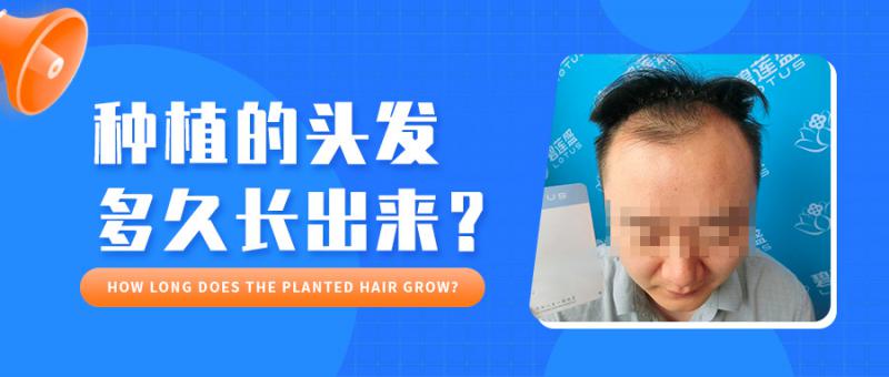 植发术后3个月，头发还没长出来，是不是？