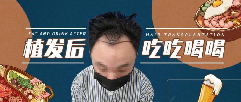 植发后可以喝碳酸饮料吗？可以吃火锅吗？