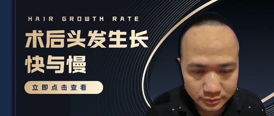 种植的头发为什么长得比原生发慢？是伤着毛囊了吗？