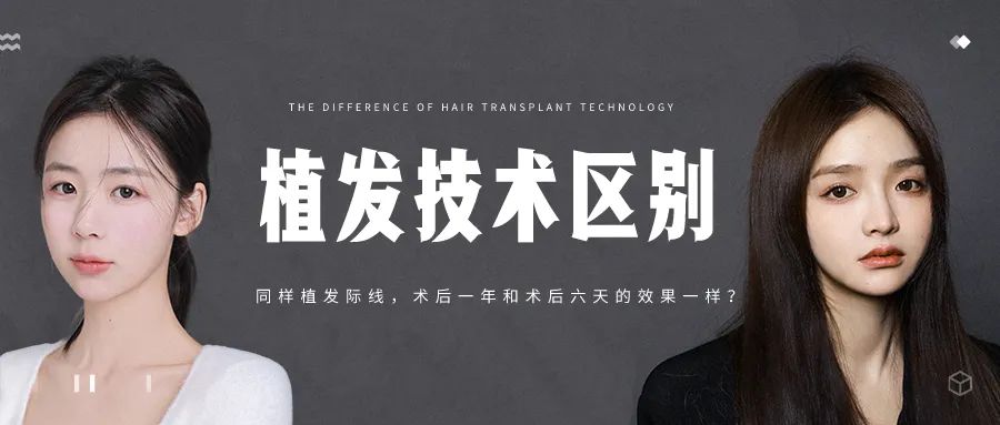 同样植发际线，为什么术后一年和术后六天的效果一样？