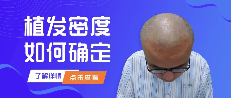 头顶稀疏，加密多少毛囊能看不到头皮？