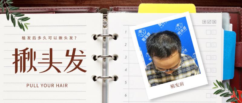 揪头发的画面你见过哪些？植发后多久可以揪头发？