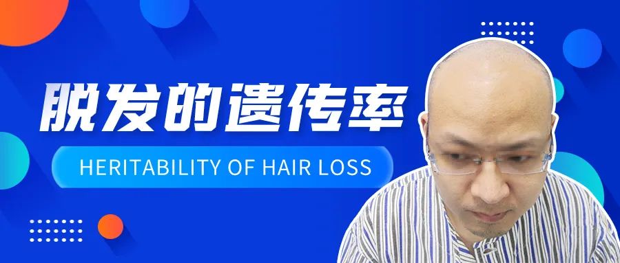 碧莲盛遗传脱发植发案例效果爸爸不脱发但是爷爷脱发