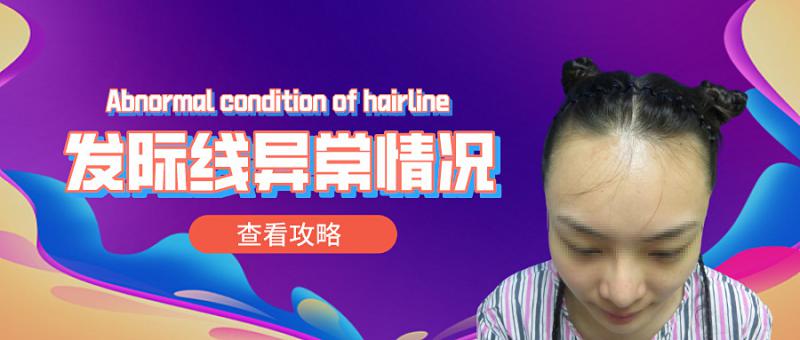 碧莲盛植发女士大脑门种植发际线植发效果图