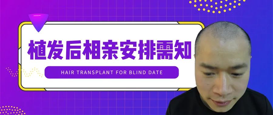 统一回答一下：植发后多久去相亲效果好？