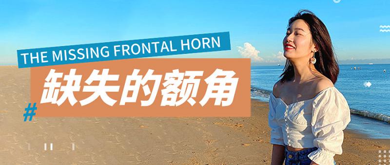 天生额角缺失美女发际线种植的效果
