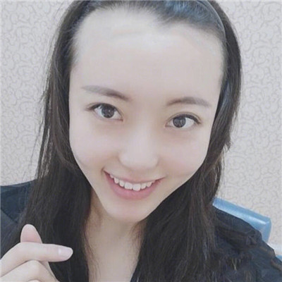 天生发际线高又不想留刘海怎么办？植个发际线就好了