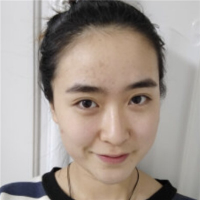 发际线太高显得头很方怎么办？做个发际线就好了