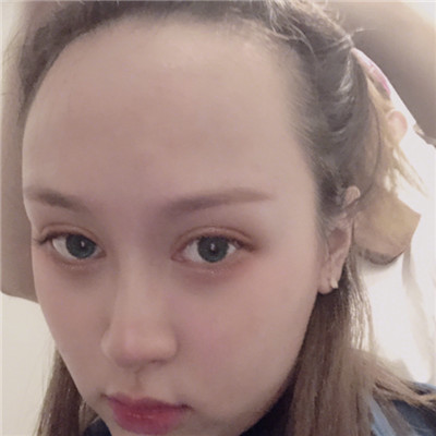 不要让大额头掩盖了你的美，做个发际线调整你就是最靓的妞儿