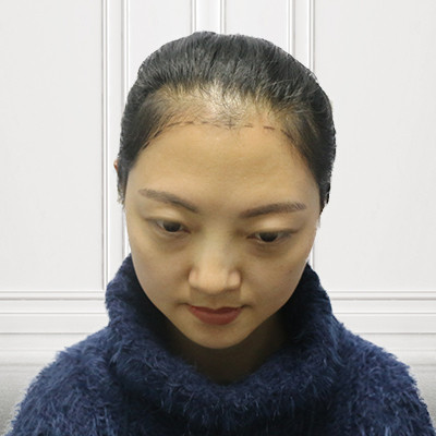 颜值不高就做个发际线遮挡一下吧