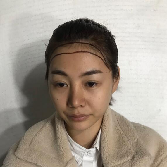 发际线不配五官比例，修正发际线高度就能让你变美