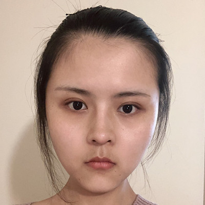 发际线太高离不开刘海，做个发际线让额头自信露出来