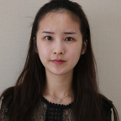 为了让发际线更完美，做了个发际线种植，效果很好