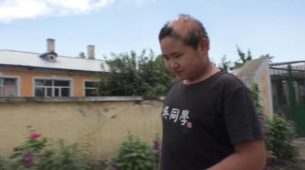 3岁男童火灾烧伤头没了头发1次植发圆10年生发梦！