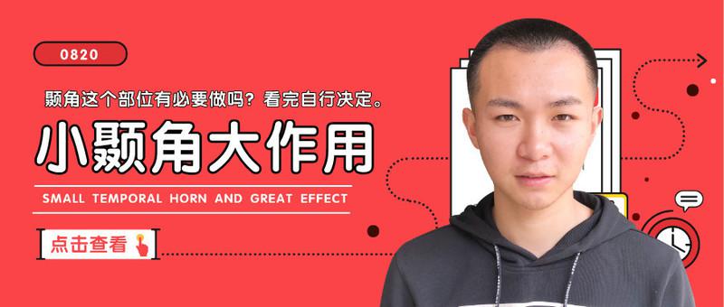 颞角这个部位有必要做植发吗？看完自行决定
