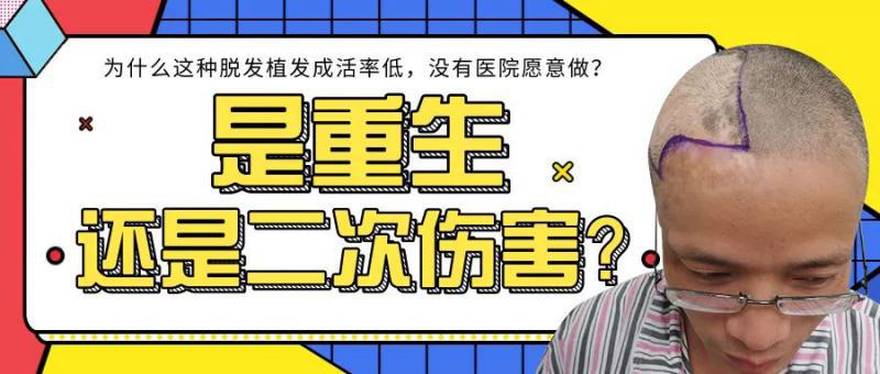 为什么这种疤痕植发成活率低，没有医院愿意做？