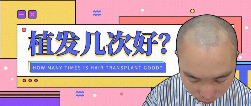 先植一部分以后再植！一生可以做几次植发？