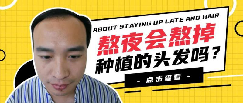 遗传性脱发经常熬夜植发是不是也没得救了？