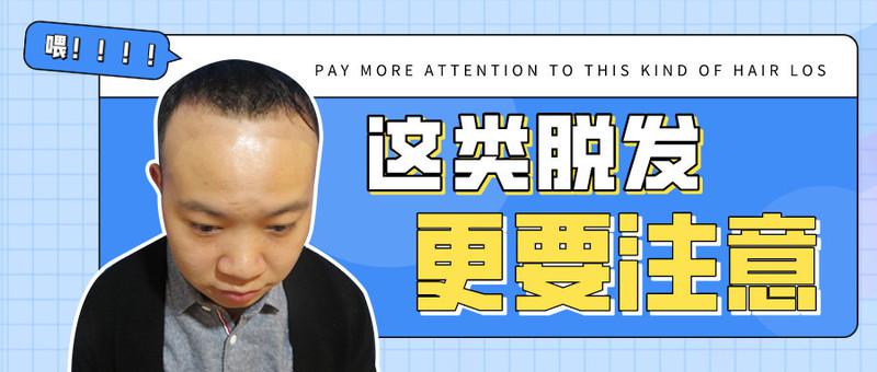 发友脱发已达4级没遗传没压力为什么？