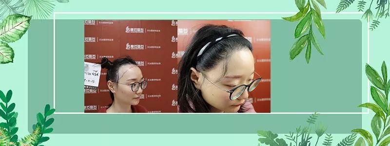 额头是检验女神的标准发际线调整女神的首选！