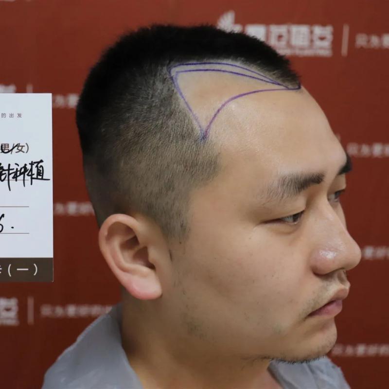 你与筷子兄弟只差一个发际线颜值逆袭的秘密
