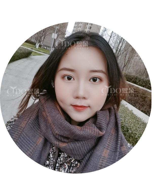 女生脂溢性脱发有治愈的吗？