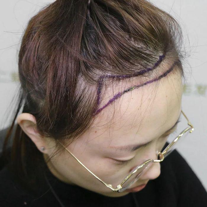 小心机调整发际线，原来减龄还可以这样！