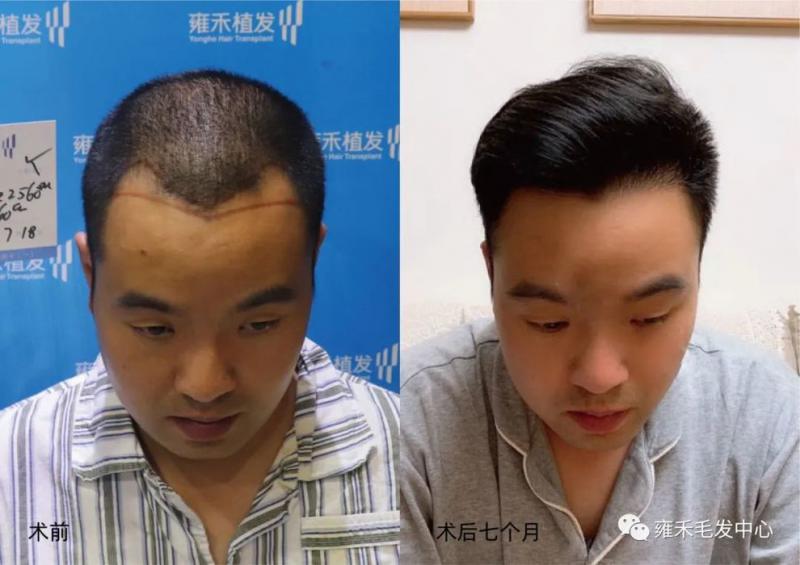 昆明雍禾采用LATTICE为陈先生种植2608单位
