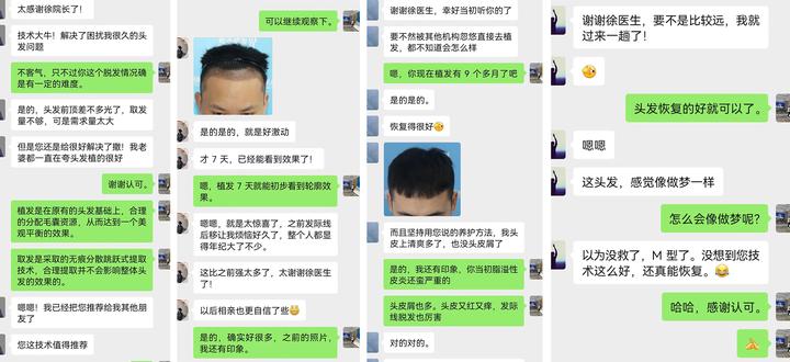 寻找100名脱发人士，1对1指导改善脱发 免费体验毛囊检测！