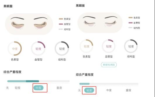 黑眼圈太重去不掉？还在怪熬夜？这份【皮肤科医生】的去黑眼圈秘籍请收好，让你通宵熬夜也不怕！