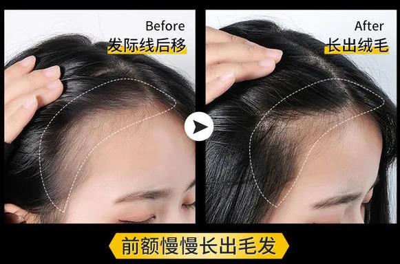 老是掉头发用什么洗发水好？为秀发注入活力