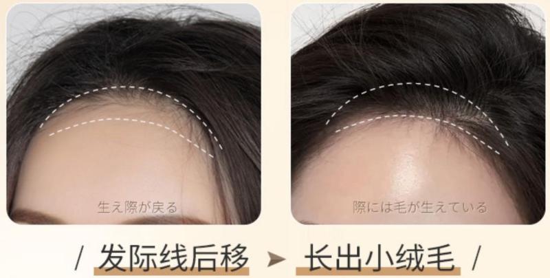 脱发怎么选防脱发洗发水？选择优质防脱洗发水