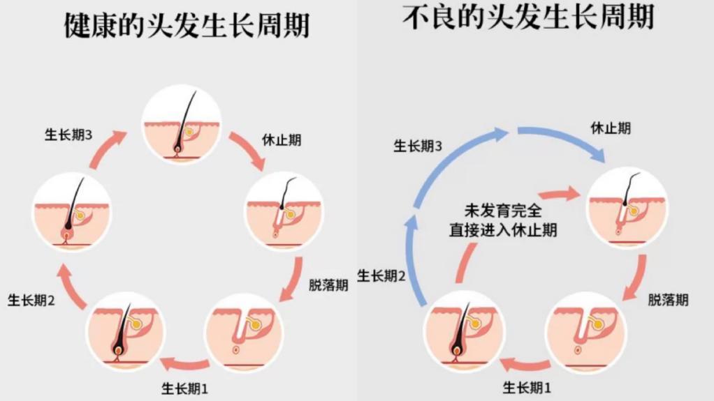 关于头发的生长周期，你知道吗？
