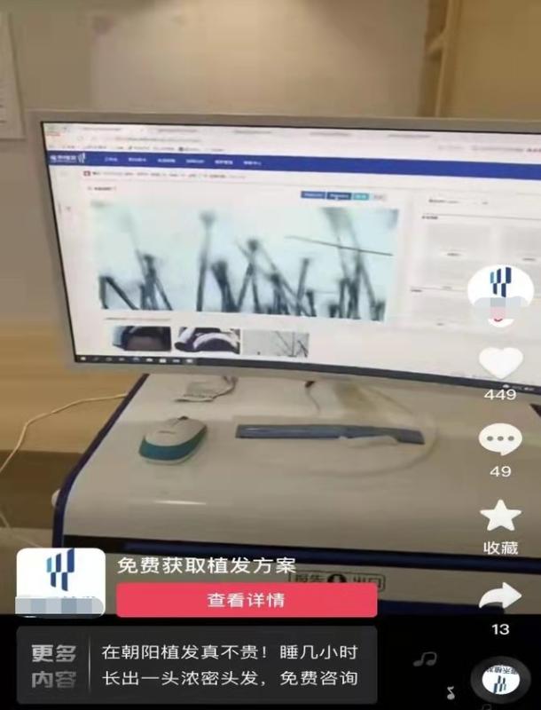 “三天学会”、“月入百万”？不能让植发“野蛮生长”