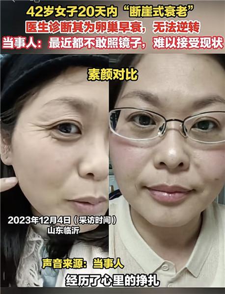 42岁“断崖式衰老”上热搜！专家：较少见，但这些是早衰常见症状｜第医线